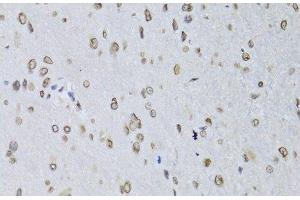 Immunohistochemistry of paraffin-embedded Rat brain using LMNB2 Polyclonal Antibody at dilution of 1:100 (40x lens). (Lamin B2 抗体)