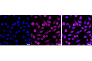Immunocytochemical staining of HepG2 cells with IKB beta antibody (ABIN7799590), 1:1,000).
