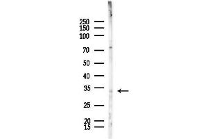 Western blot analysis of lysates from HepG2 cells(starvation,24h treatment), using PIM2 Antibody at 1/1000 dilution.