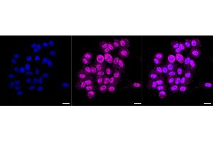 Immunocytochemical staining of HepG2 cells with BCL11 transcription factor B antibody (ABIN7800915), 1:1,000). (Recombinant BCL11 Transcription Factor B 抗体)