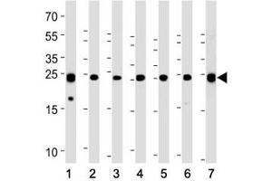 Western Blotting (WB) image for anti-Ubiquitin Carboxyl-terminal Esterase L1 (Ubiquitin Thiolesterase) (UCHL1) (AA 187-216) antibody (ABIN3029422)