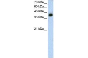 Western Blotting (WB) image for anti-Microtubule Associated Tumor Suppressor 1 (MTUS1) antibody (ABIN2462816) (MTUS1 抗体)