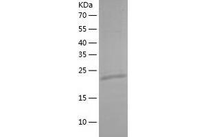 Western Blotting (WB) image for MOB Kinase Activator 3B (MOB3B) (AA 1-216) protein (His tag) (ABIN7124010) (MOBKL2B Protein (AA 1-216) (His tag))