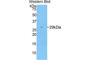 Western Blotting (WB) image for anti-A Disintegrin and Metallopeptidase Domain 6A (ADAM6A) (AA 419-664) antibody (ABIN1857893)