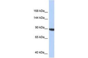 Image no. 1 for anti-KIAA1549 (KIAA1549) (C-Term) antibody (ABIN6747731) (KIAA1549 抗体  (C-Term))