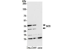 anti-SCD/SCD1/Stearoyl-CoA Desaturase (AA 1-50) antibody