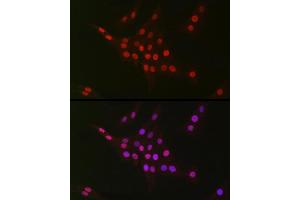 Immunofluorescence analysis of PC-12 cells using CTBP2 Rabbit mAb (ABIN7265979) at dilution of 1:100 (40x lens).