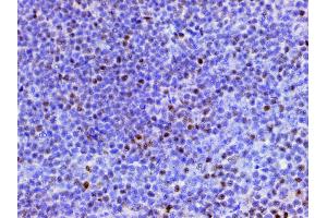 Immunohistochemistry (IHC) image for anti-Cofilin 1 (CFL1) (pSer3) antibody (ABIN6255180)