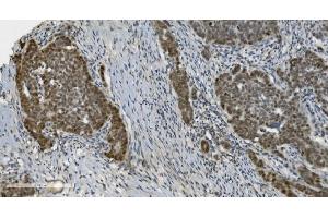 IHC analysis of PARP using anti-PARP antibody (ABIN7602277). (PARP1 抗体  (AA 670-858))