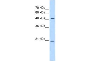 Western Blotting (WB) image for anti-Glucosaminyl (N-Acetyl) Transferase 4, Core 2 (Beta-1,6-N-Acetylglucosaminyltransferase) (GCNT4) antibody (ABIN2463054) (GCNT4 抗体)