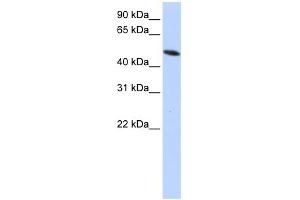 WB Suggested Anti-PDIA6 Antibody Titration: 0. (PDIA6 抗体  (Middle Region))