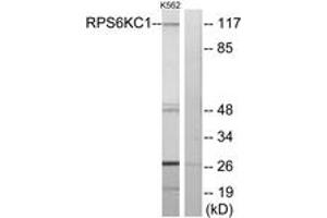 Western blot analysis of extracts from K562 cells, using RPS6KC1 Antibody. (RPS6KC1 抗体  (AA 231-280))