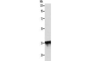 Gel: 10 % SDS-PAGE, Lysate: 40 μg, Lane: MCF7 cells, Primary antibody: ABIN7131160(SPATA2L Antibody) at dilution 1/500, Secondary antibody: Goat anti rabbit IgG at 1/8000 dilution, Exposure time: 30 seconds (SPATA2L 抗体)