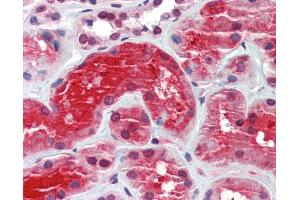 Anti-CRYM antibody IHC staining of human kidney. (CRYM 抗体)