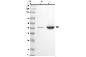 Western blot analysis of FOS using anti-FOS antibody (ABIN7604168).
