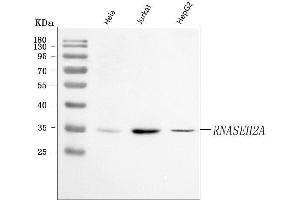 Western blot analysis of RNASEH2A using anti-RNASEH2A antibody (ABIN7600899).