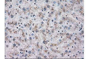 Immunohistochemical staining of paraffin-embedded liver tissue using anti-CHEK2mouse monoclonal antibody. (CHEK2 抗体)