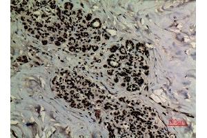 Immunohistochemistry (IHC) analysis of paraffin-embedded Human Breast, antibody was diluted at 1:100. (APEX1 抗体  (acLys6))