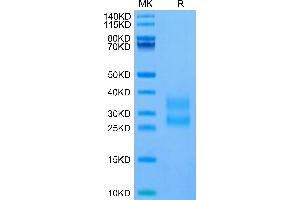 SDS-PAGE (SDS) image for Inducible T-Cell Co-Stimulator (ICOS) (AA 21-144), (C137S), (C138S) protein (His tag) (ABIN7274841)
