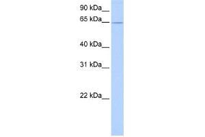 WB Suggested Anti-ZNF526 Antibody Titration:  0. (ZNF526 抗体  (C-Term))