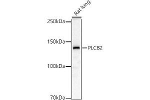 Western blot analysis of extracts of Rat lung, using PLCB2 antibody (ABIN6133052, ABIN6145747, ABIN6145748 and ABIN6224164) at 1:1000 dilution. (Phospholipase C beta 2 抗体  (AA 1-199))