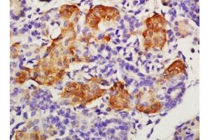 Tissue/cell: mouse embryo tissue, 4% Paraformaldehyde-fixed and paraffin-embeddedAntigen retrieval: citrate buffer (0. (GFRA4 抗体  (AA 51-150))