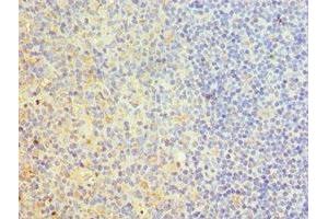 Immunohistochemistry of paraffin-embedded human tonsil tissue using ABIN7173837 at dilution of 1:100 (TNFRSF1D (AA 257-386) 抗体)