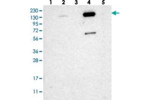 Western blot analysis of Lane 1: RT-4, Lane 2: U-251 MG, Lane 3: Human Plasma, Lane 4: Liver, Lane 5: Tonsil with ZNF629 polyclonal antibody  at 1:250-1:500 dilution. (Zinc Finger Protein 629 (ZNF629) 抗体)