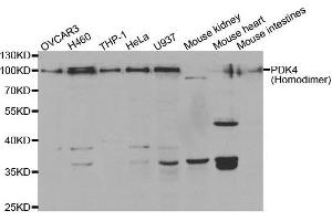 Western Blotting (WB) image for anti-Pyruvate Dehydrogenase Kinase, Isozyme 4 (PDK4) antibody (ABIN6220032) (PDK4 抗体)