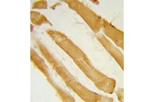 Formalin-fixed and paraffin-embedded human skeletal muscle reacted with ITPKC Antibody (N-term) followed which was peroxidase-conjugated to the secondary antibody, followed by DAB staining. (ITPKC 抗体  (N-Term))