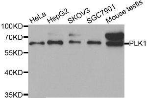 Western blot analysis of extracts of various cell lines, using PLK1 antibody. (PLK1 抗体)