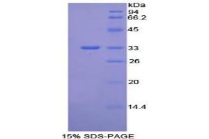 SDS-PAGE analysis of Mouse Integrin beta 1 Protein. (ITGB1 蛋白)