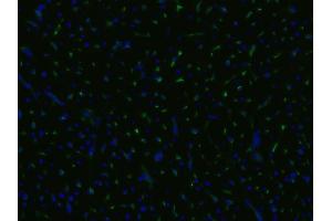 Immunocytochemistry staining of an infarcted porcine heart with anti-CD105 (MEM-229, green), cell nuclei stained with DAPI (blue). (Endoglin 抗体)