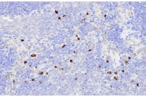 Immunohistochemistry of paraffin-embedded Rat spleen using SERPINB2 Polycloanl Antibody at dilution of 1:200 (SERPINB2 抗体)
