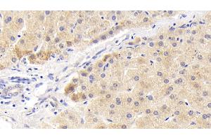 Detection of MAPKAP1 in Human Liver Tissue using Polyclonal Antibody to Mitogen Activated Protein Kinase Associated Protein 1 (MAPKAP1) (MAPKAP1 抗体  (AA 8-236))