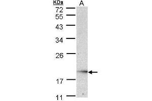 WB Image Sample (30 ug of whole cell lysate) A: Raji , 12% SDS PAGE antibody diluted at 1:1000 (UBE2G2 抗体)