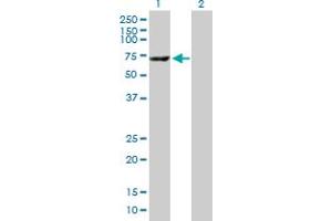 Western Blot analysis of CES1 expression in transfected 293T cell line by CES1 MaxPab polyclonal antibody. (CES1 抗体  (AA 1-566))