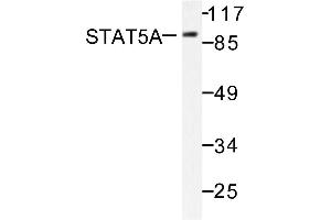 Image no. 1 for anti-Signal Transducer and Activator of Transcription 5A (STAT5A) antibody (ABIN271829)
