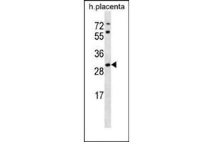 Western blot analysis in human placenta tissue lysates (35ug/lane) using STARD4 Antibody (N-term) Cat. (STARD4 抗体  (N-Term))