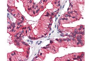 Human, Prostate: Formalin-Fixed Paraffin-Embedded (FFPE) (REEP5 抗体  (C-Term))