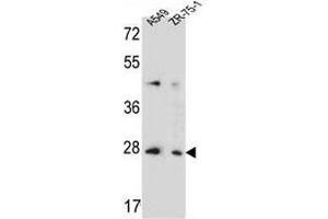 T4S4 Antibody (N-term) western blot analysis in A549,ZR-75-1 cell line lysates (35µg/lane). (TM4SF4 抗体  (N-Term))