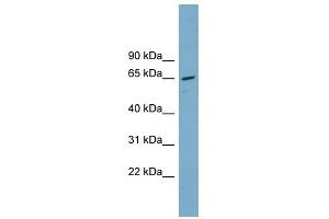 PPP2R1A antibody used at 1 ug/ml to detect target protein. (PPP2R1A 抗体)