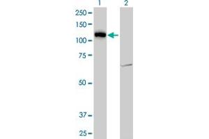 Western Blotting (WB) image for anti-Lethal Giant Larvae Homolog 2 (LLGL2) (AA 101-200) antibody (ABIN466051) (LLGL2 抗体  (AA 101-200))