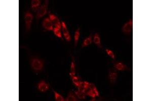 ABIN6275466 staining HeLa by IF/ICC. (RAB33A 抗体  (Internal Region))
