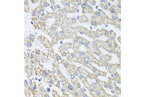Immunohistochemistry of paraffin-embedded human liver injury using SDC2 antibody at dilution of 1:100 (x40 lens). (Syndecan 2 抗体)