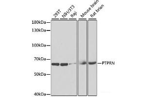 Western blot analysis of extracts of various cell lines using PTPRN Polyclonal Antibody at dilution of 1:1000. (PTPRN 抗体)