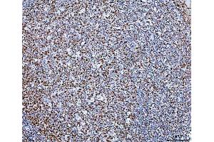 IHC analysis of SP1 using anti-SP1 antibody (ABIN7601559). (SP1 抗体  (AA 384-603))