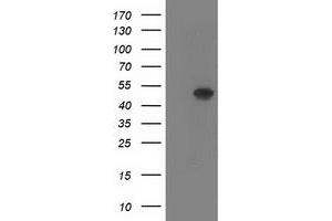 Western Blotting (WB) image for anti-SET Domain Containing (Lysine Methyltransferase) 7 (SETD7) antibody (ABIN1500904) (SETD7 抗体)