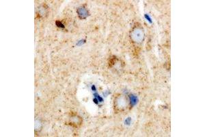 Immunohistochemical analysis of Ribophorin-2 staining in rat brain formalin fixed paraffin embedded tissue section. (Ribophorin II 抗体)