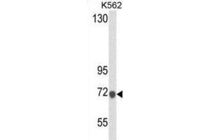 Western Blotting (WB) image for anti-Lactotransferrin (LTF) antibody (ABIN2995307) (Lactoferrin 抗体)